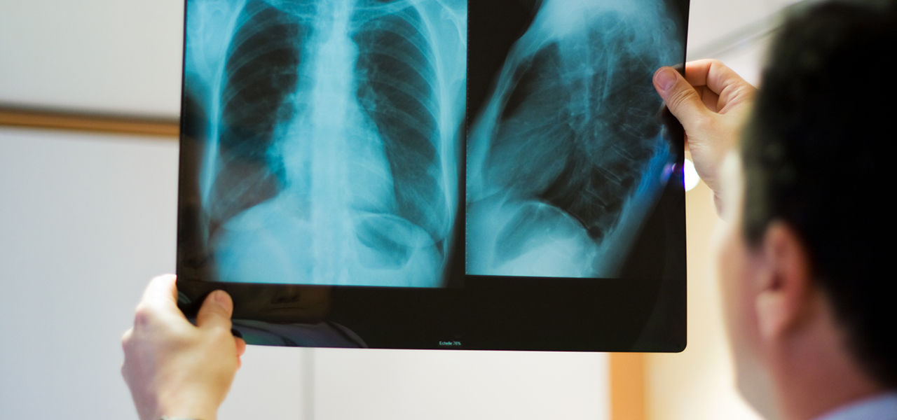 doctor reviews chest xrays